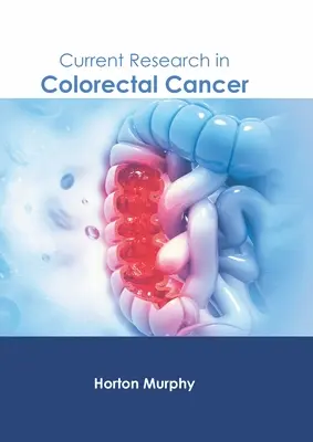 Aktuelle Forschung zu kolorektalem Krebs - Current Research in Colorectal Cancer