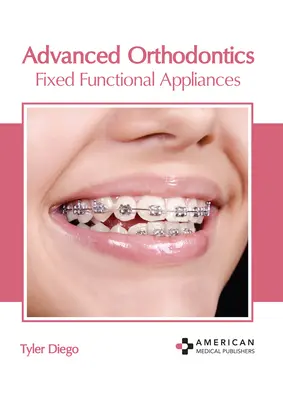 Fortgeschrittene Kieferorthopädie: Feste funktionelle Apparaturen - Advanced Orthodontics: Fixed Functional Appliances