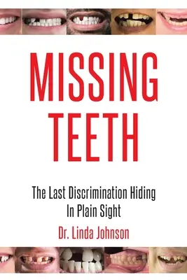 Fehlende Zähne: Die letzte Diskriminierung, die sich im Verborgenen abspielt - Missing Teeth: The Last Discrimination Hiding in Plain Sight