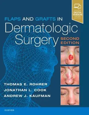 Lappen und Transplantate in der dermatologischen Chirurgie - Flaps and Grafts in Dermatologic Surgery