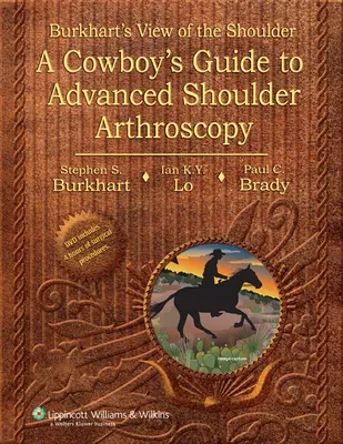 Burkharts Blick auf die Schulter - Ein Leitfaden für Cowboys zur fortgeschrittenen Schulterarthroskopie - Burkhart's View of the Shoulder - A Cowboy's Guide to Advanced Shoulder Arthroscopy