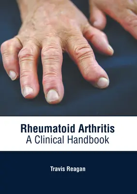Rheumatoide Arthritis: Ein klinisches Handbuch - Rheumatoid Arthritis: A Clinical Handbook