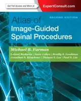 Atlas der bildgesteuerten Wirbelsäuleneingriffe - Atlas of Image-Guided Spinal Procedures