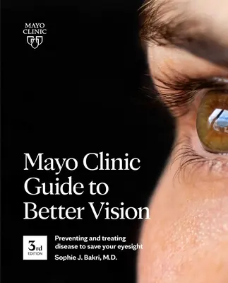 Mayo Clinic Leitfaden für besseres Sehen (3. Auflage): Vorbeugung und Behandlung von Krankheiten zur Rettung Ihres Augenlichts - Mayo Clinic Guide to Better Vision (3rd Edition): Preventing and Treating Disease to Save Your Eyesight