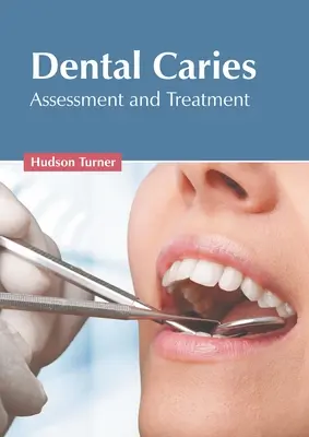 Zahnkaries: Beurteilung und Behandlung - Dental Caries: Assessment and Treatment