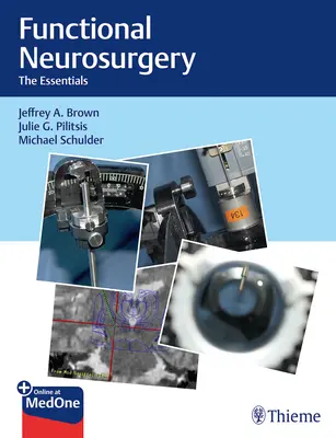 Funktionelle Neurochirurgie: Das Wesentliche - Functional Neurosurgery: The Essentials