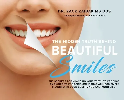 Die verborgene Wahrheit hinter dem schönen Lächeln: Die Geheimnisse der Verbesserung Ihrer Zähne für ein exquisites, einnehmendes Lächeln, das Sie positiv verändern wird - The Hidden Truth Behind Beautiful Smiles: The secrets to enhancing your teeth to produce an exquisite, engaging smile that will positively transform y