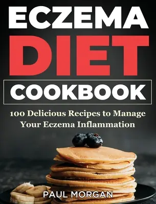 Ekzem-Diät-Kochbuch: 100 leckere Rezepte zur Behandlung von Ekzem-Entzündungen - Eczema DIet Cookbook: 100 Delicious Recipes to Manage your Eczema Inflammation