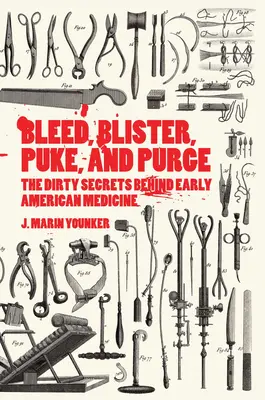 Bluten, blasen, kotzen und purgieren: Die schmutzigen Geheimnisse der frühen amerikanischen Medizin - Bleed, Blister, Puke, and Purge: The Dirty Secrets Behind Early American Medicine