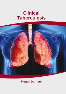 Klinische Tuberkulose - Clinical Tuberculosis