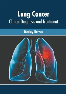 Lungenkrebs: Klinische Diagnostik und Behandlung - Lung Cancer: Clinical Diagnosis and Treatment