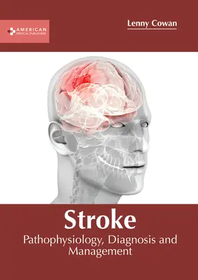 Schlaganfall: Pathophysiologie, Diagnose und Behandlung - Stroke: Pathophysiology, Diagnosis and Management