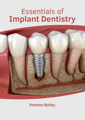 Grundlagen der Implantologie - Essentials of Implant Dentistry