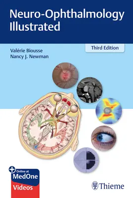 Neuro-Ophthalmologie illustriert - Neuro-Ophthalmology Illustrated