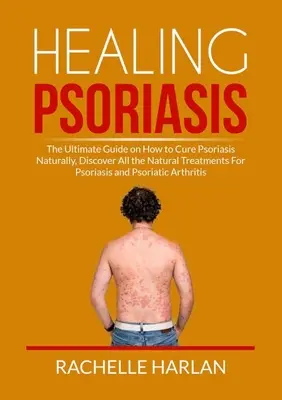 Psoriasis heilen: Der ultimative Leitfaden zur natürlichen Heilung von Psoriasis, Entdecken Sie alle natürlichen Behandlungen für Psoriasis und Psoriatiker - Healing Psoriasis: The Ultimate Guide on How to Cure Psoriasis Naturally, Discover All the Natural Treatments For Psoriasis and Psoriatic