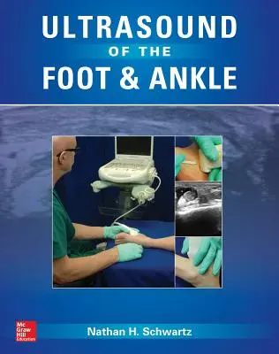 Ultraschall von Fuß und Sprunggelenk - Ultrasound of the Foot and Ankle