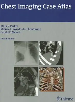 Atlas zur Thoraxbildgebung - Chest Imaging Case Atlas