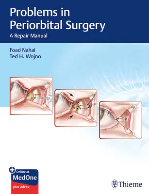 Probleme in der periorbitalen Chirurgie: Ein Reparaturhandbuch - Problems in Periorbital Surgery: A Repair Manual