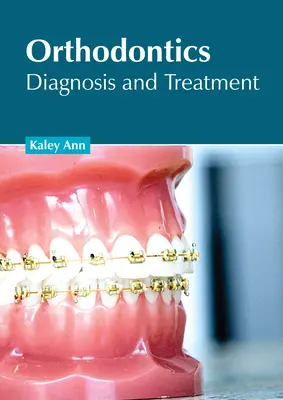 Kieferorthopädie: Diagnose und Behandlung - Orthodontics: Diagnosis and Treatment