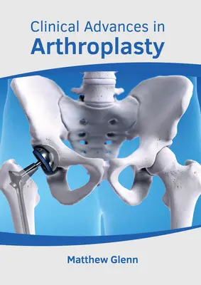 Klinische Fortschritte in der Endoprothetik - Clinical Advances in Arthroplasty