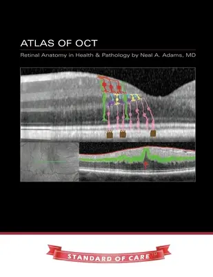 Atlas der OCT: Netzhautanatomie in Gesundheit und Pathologie - Atlas of OCT: Retinal Anatomy in Health & Pathology