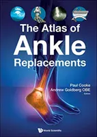 Der Atlas der Knöchelersatzoperationen - The Atlas of Ankle Replacements