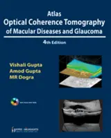 Atlas Optische Kohärenztomographie von Makulakrankheiten und Glaukom - Atlas Optical Coherence Tomography of Macular Diseases and Glaucoma