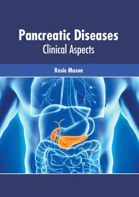 Bauchspeicheldrüsenerkrankungen: Klinische Aspekte - Pancreatic Diseases: Clinical Aspects