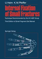 Interne Fixation von kleinen Frakturen: Von der Ao-Asif-Gruppe empfohlene Technik - Internal Fixation of Small Fractures: Technique Recommended by the Ao-Asif Group