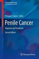 Peniskrebs: Diagnose und Behandlung - Penile Cancer: Diagnosis and Treatment