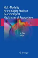 Multimodale Neuroimaging-Studie über neurobiologische Mechanismen der Akupunktur - Multi-Modality Neuroimaging Study on Neurobiological Mechanisms of Acupuncture