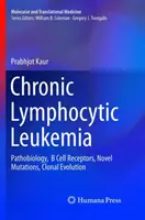 Chronische lymphatische Leukämie: Pathobiologie, B-Zell-Rezeptoren, neuartige Mutationen, klonale Entwicklung - Chronic Lymphocytic Leukemia: Pathobiology, B Cell Receptors, Novel Mutations, Clonal Evolution