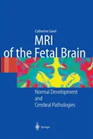 MRT des fötalen Gehirns: Normale Entwicklung und zerebrale Pathologien - MRI of the Fetal Brain: Normal Development and Cerebral Pathologies