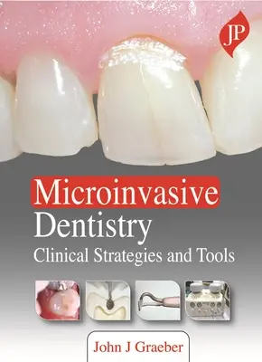 Mikroinvasive Zahnmedizin - Klinische Strategien und Werkzeuge - Microinvasive Dentistry - Clinical Strategies and Tools