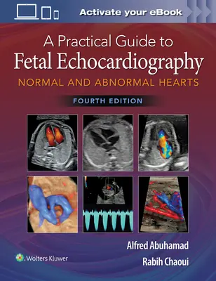 Ein praktischer Leitfaden zur fetalen Echokardiographie: Normale und abnorme Herzen - A Practical Guide to Fetal Echocardiography: Normal and Abnormal Hearts