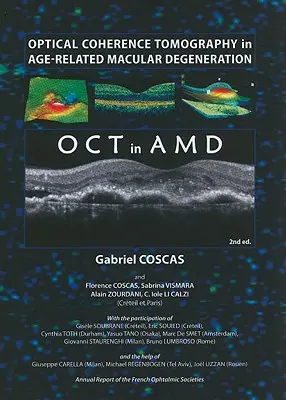 Optische Kohärenztomographie bei altersbedingter Makuladegeneration - Optical Coherence Tomography in Age-Related Macular Degeneration