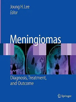 Meningiome: Diagnose, Behandlung und Ergebnisse - Meningiomas: Diagnosis, Treatment, and Outcome