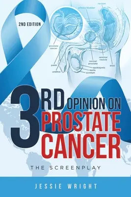 Die 3. Meinung zu Prostatakrebs: Das Drehbuch - 3rd Opinion on Prostate Cancer: The Screenplay