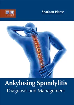 Spondylitis ankylosans: Diagnose und Behandlung - Ankylosing Spondylitis: Diagnosis and Management