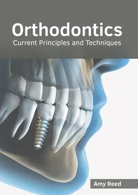 Kieferorthopädie: Aktuelle Prinzipien und Techniken - Orthodontics: Current Principles and Techniques