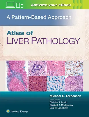 Atlas der Leberpathologie: Eine musterbasierte Herangehensweise - Atlas of Liver Pathology: A Pattern-Based Approach