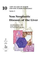 Nicht-neoplastische Erkrankungen der Leber - Non-Neoplastic Diseases of the Liver