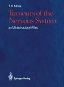 Tumore des Nervensystems: Ein ultrastruktureller Atlas - Tumours of the Nervous System: An Ultrastructural Atlas