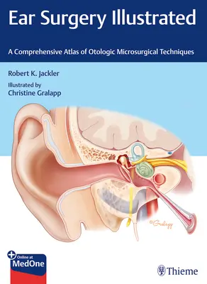 Illustrierte Ohrchirurgie: Ein umfassender Atlas der mikrochirurgischen Techniken in der Otologie - Ear Surgery Illustrated: A Comprehensive Atlas of Otologic Microsurgical Techniques