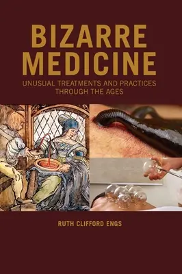 Bizarre Medizin: Ungewöhnliche Behandlungen und Praktiken durch die Jahrhunderte - Bizarre Medicine: Unusual Treatments and Practices through the Ages