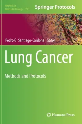 Lungenkrebs: Methoden und Protokolle - Lung Cancer: Methods and Protocols