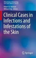 Klinische Fälle von Infektionen und Infestationen der Haut - Clinical Cases in Infections and Infestations of the Skin