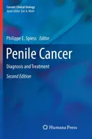 Peniskrebs: Diagnose und Behandlung - Penile Cancer: Diagnosis and Treatment