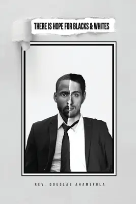 Es gibt Hoffnung für Schwarze und Weiße - There Is Hope for Blacks & Whites