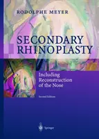 Sekundäre Rhinoplastik: Einschließlich Rekonstruktion der Nase - Secondary Rhinoplasty: Including Reconstruction of the Nose